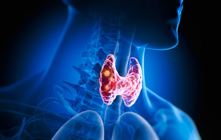 iodine_thyroid